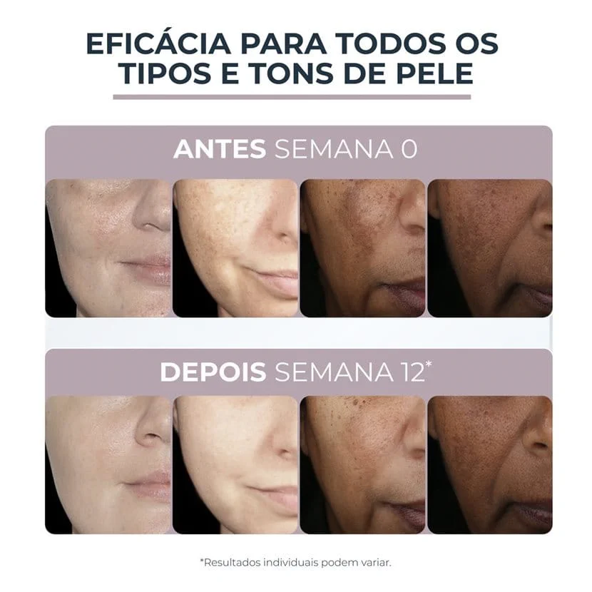 Comparativo antes e depois do uso do produto